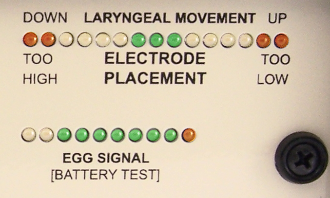 Larynxposition